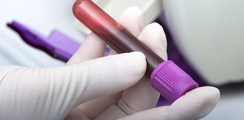 Anemia and Abnormal Blood Tests