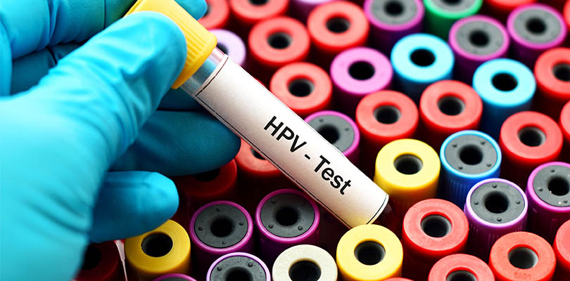 A medical professional is holding a HPV blood test tube