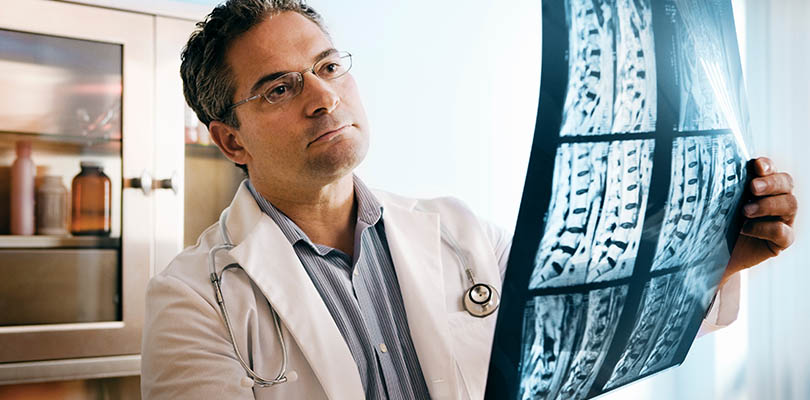 A doctor is reviewing spinal x-rays